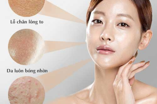 Review top 5 mặt nạ cho da dầu không thể thiếu trong mùa hè