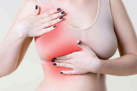 Hạch sữa là gì? Cách khắc phục tình trạng này ra sao?