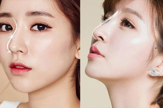 TOP 5 công nghệ nâng mũi mới nhất 2023 hiện nay