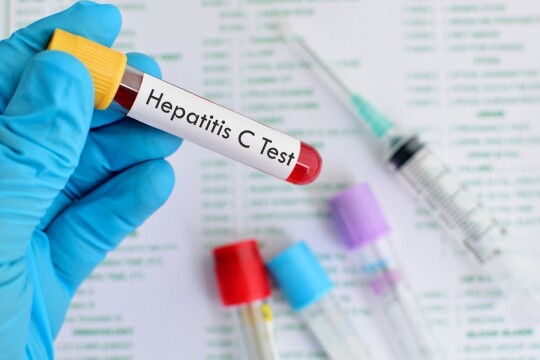 HCV là gì? Tổng quan về căn bệnh do HCV gây ra